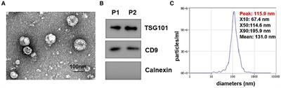 Individualized lipid profile in urine-derived extracellular vesicles from clinical patients with Mycobacterium tuberculosis infections